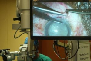 عمليات العيون في جنوب إفريقيا