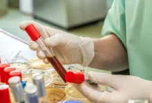 مكافحة الملاريا