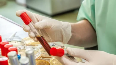 مكافحة الملاريا